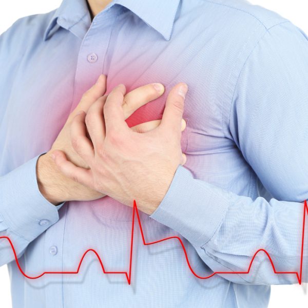 Signs of a Heart Attack